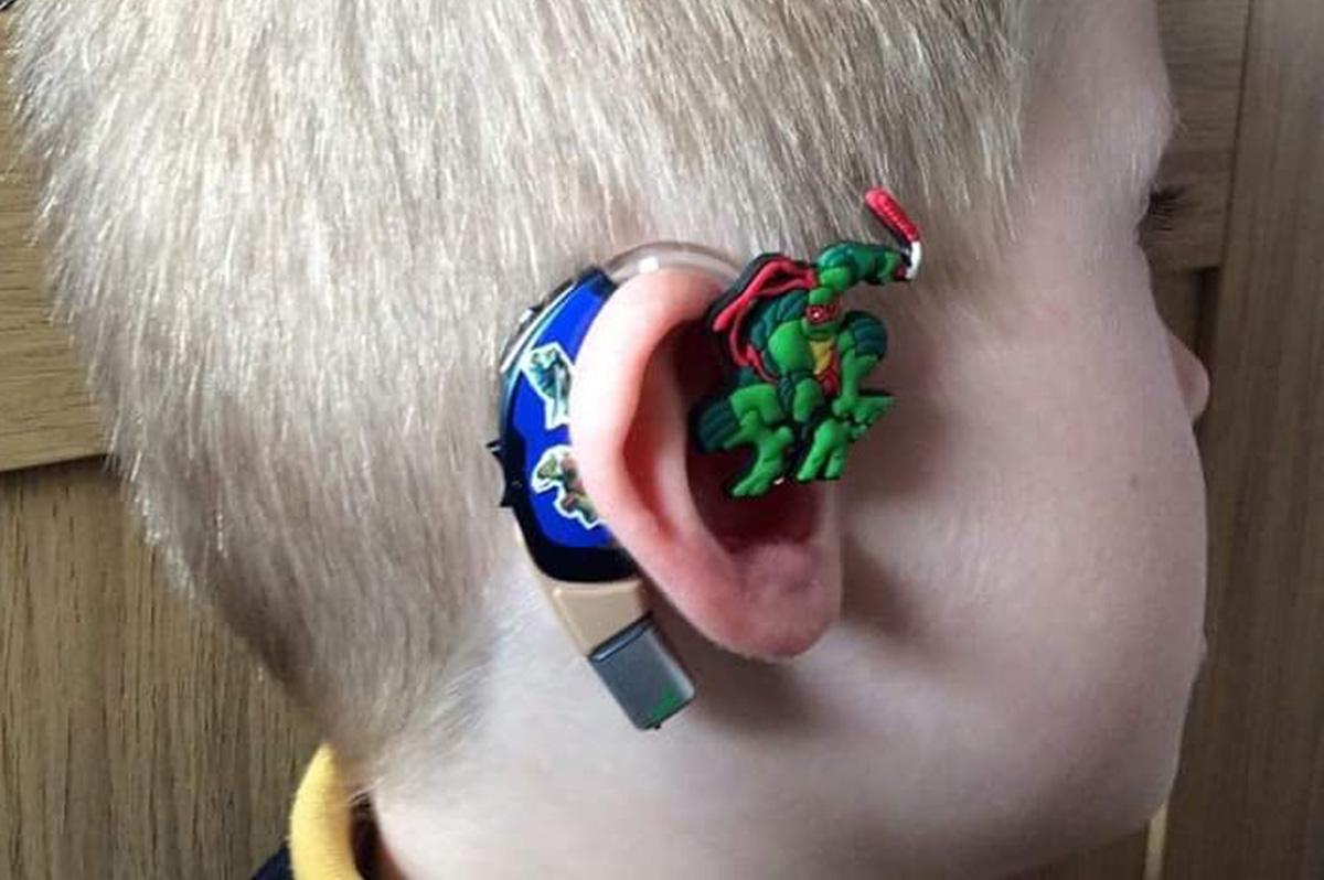 Super-Mãe personaliza aparelho auditivo do filho com heróis